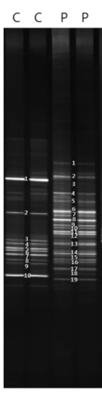 Fig. 1. DGGE banding patterns of amplified 16S rRNA gene obtained  from Cinachyrella sp