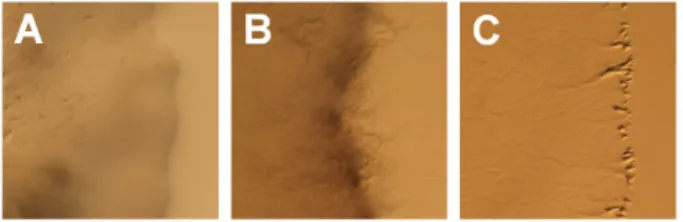 Fig. 1. Growth of C. crocatus KYC2823 on agar plates. C. crocatus KYC2823 was inoculated on CY medium containing 0.5% (A), 1.5%