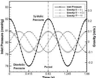 Fig. 2 Modeling and grid generation of stenosed blood vessel