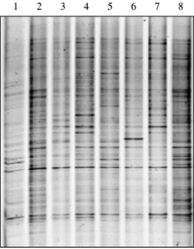 Fig.  5.  DGGE  profiles  of  the  bacterial  populations  in  the  rhizo- rhizo-sphere  soil  of  X