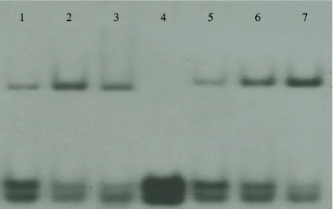 Fig.  2.  Gel  retardation  assay  using  21  bp  DNA  duplex  synthesized  based  on  consensus  sequences  from  ilvIH  DNA