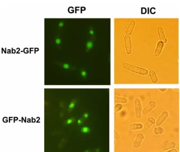 Fig. 4. Localization of Nab2 proteins fused to GFP. Nab2 was tagged with GFP at its amino-terminal (GFP-Nab2) or carboxy-terminal end (Nab2-GFP)