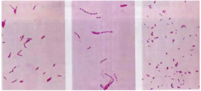 Fig. 1.  The detection of acid fast bacilli in stained smears.