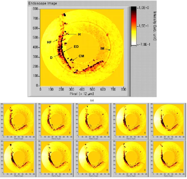 FIG. 6. The cartilage part of external auditory meatus of human: (a) an endoscopic OCT image and (b) the endoscopic OCT images in  endoscopic OCT video for 1 second.