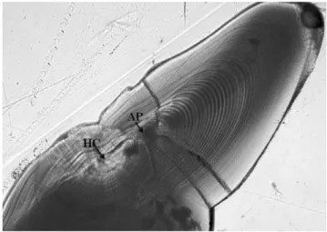 Fig. 5. Microphotograph of frontal plane of sagitta from a juvenile Pacific cod (62.5 mm TL) under the transmitted light