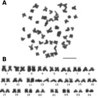 Table 1. Relative lengths and total lengths ( µ m) of chro- chro-mosomes of Culter brevicauda*