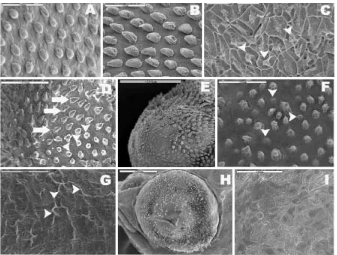 Fig. 2. Minute tubercles distributed on the skin surface of larvae of Acheilognathus koreensis, A, Hemispheric minute tubercles cover at the anterior epidermal region of the yolk (region A), 1 day after hatching