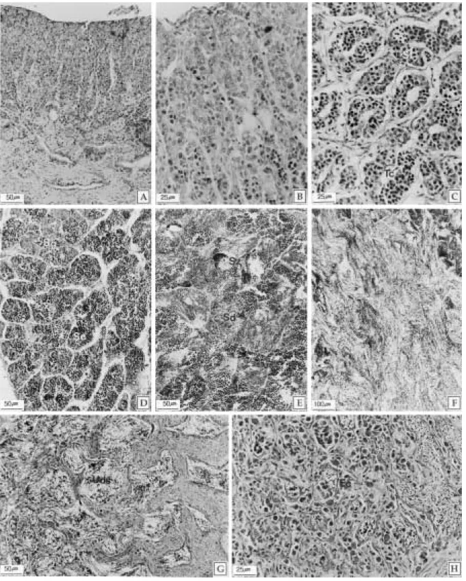 Fig. 8. Testicular developmental stage of the slimy, Leiognathus nuchalis. A: Section of resting stage showing the spermatogonia of interphase