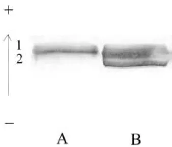 Fig. 4.  Photograph of LDH isozyme appeared in P. sp. (A) and P. indicus (B).