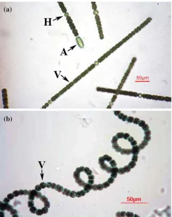Fig. 1. Photo of Anabaena circinalis found in North Han River.