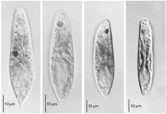 Fig. 2. Two morphotypes of Euglena viridis occurred in urban drainages in Korea. A-B. Morphotype I cells