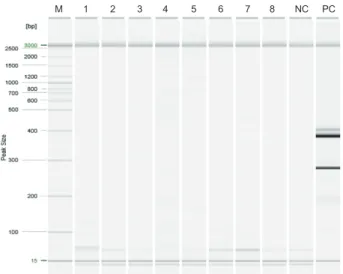 Fig. 3. Representative results of PCR of the AHPND related genes  (pirA/pirB) using the duplex PCR for V