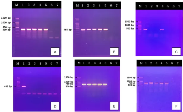 Fig. 2. PCR assay for the detection of various gene structures in Vibrio parahaemolyticus