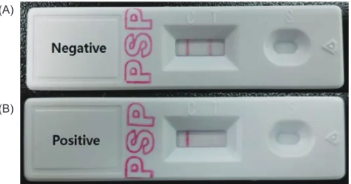 Fig. 3. Correlation between mouse bioassay and post-column oxi- oxi-dation-high performance liquid chromatography (HPLC) method.