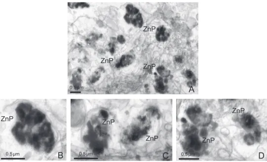 Fig. 10. TEM micrographs of the hepatopancreas from abalone Haliotis discus hannai of zinc hot-dip galvanized steel sheet exposure group