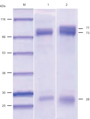 Fig. 1. SDS-PAGE analysis of olive flounder Paralichthys olivaceus  IgM purified with mannan-binding protein (MBP) and protein L  affinity columns