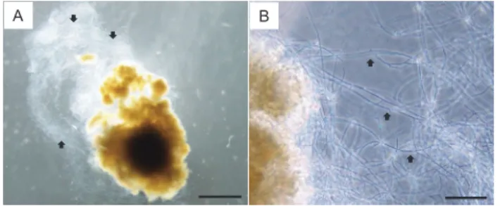 Fig. 1. Gametophyte attached to fungi (arrows) (A). Magnification  of fungi (arrows) (B)