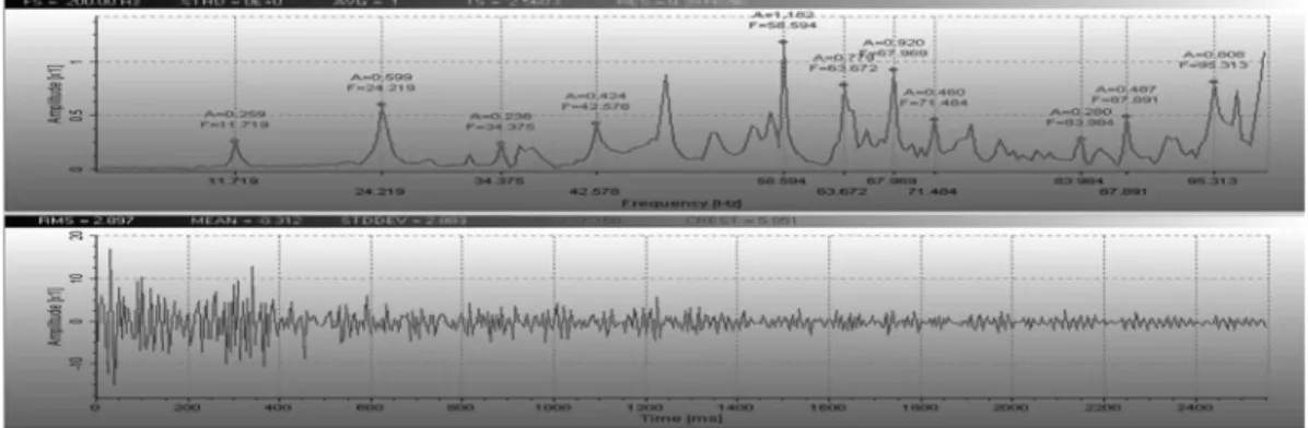 Fig. 9 Hammering Location : B, Sensor Location : LL (W.L. 4.0 m) Table 4. Results of On-site Experiment