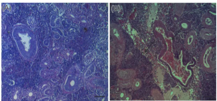 Fig. 2. Histological changes in the kidney of the olive flounder  Paralichthys olivaceus