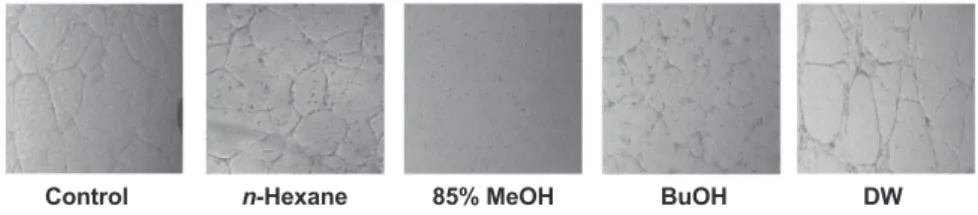 Fig. 5. Effects of proliferation inhibition against HMEC-1 cell of solvent fractions isolated by column chromatography.