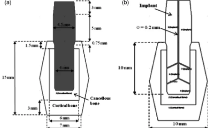 Fig. 1 shows the cross sectional view of implants and mandible with dimensions constructed in COMSOL