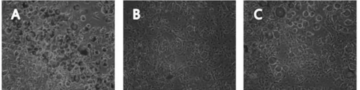 Fig. 4. Inhibitory effect of Cucurbita moschata Duch water extracts on the lipid accumulation in 3T3-L1 adipocytes.