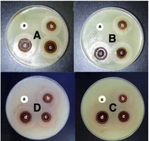 Table  5.  Growth  inhibition  zone(mm)  of  microorganisms  by  different  concentrations  of  green  tea  extract