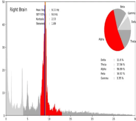 Fig.  1.  Frequency  of  EEG_Data