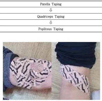 Fig.  1.  Mineral  Taping