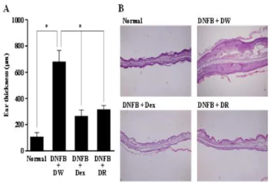 Fig.  7.  Effects  of  DR  on  DNFB-induced  ear  swelling. 