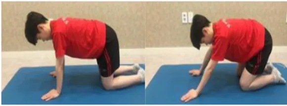 Fig.  1.  Thoracic extension  strengthening exercise