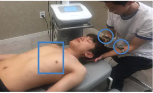 Fig.  4.  Application  of  TECAR  Therapy.  Physical therapist  weared  the  mobile  electrode  in  the  middle  of  forearm(circle)  and  fixed  electrode  was  positioned  under  patients  upper  back(square)