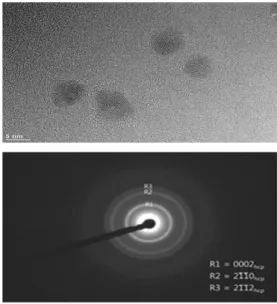 Fig.  2.  FETEM  image  and  lattice  pattern  of  CdSe/ZnS  quantum  dots. 