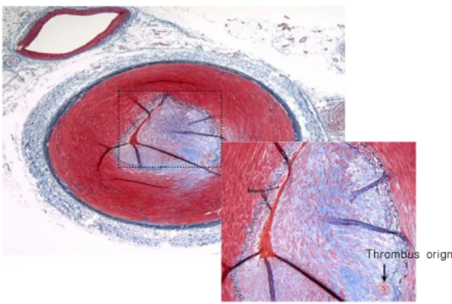 Fig.  10.  Artery  after  Verhoeff–Masson  elastic-trichrome  stain. 으로  실험을  위한  혈관  처리  과정에서  발생하는  현상 이다