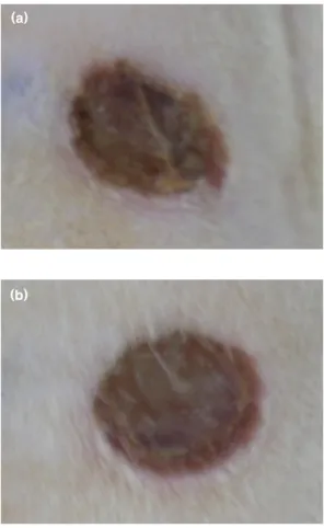 Fig.  4.  Result  of  wound  healing.