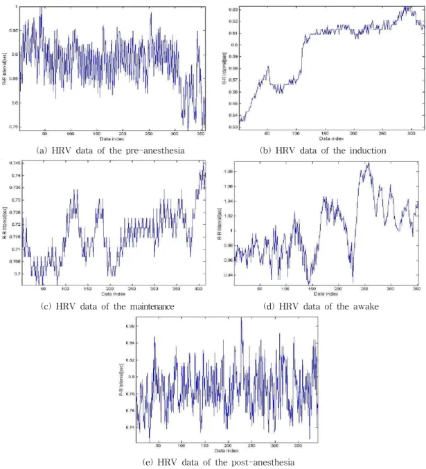 Fig. 7. Time series HRV data acquired of each anesthesia stages.