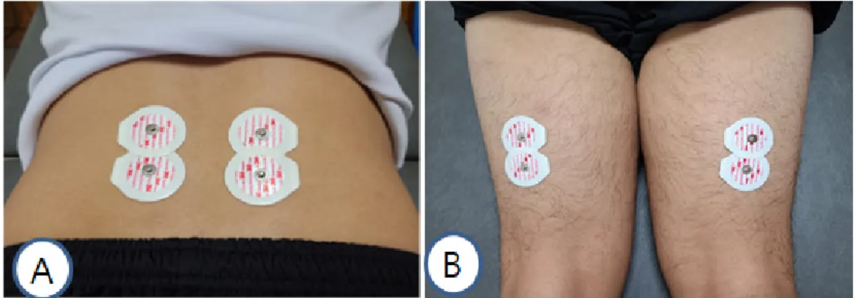 Fig 2. Electrode attachment position A: erector spinae, B: hamstring muscles