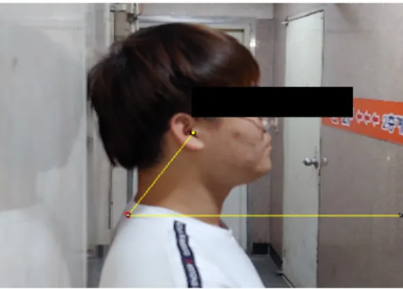 Fig 1. Forward neck measurement