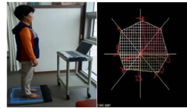 Fig 2. Myoton PRO