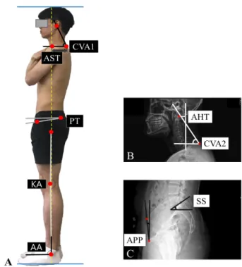 Fig 1. Posture measurement parameters A;  CA-SPR, B; X-ray(haea and  neck), C; X-ray(pelvic)