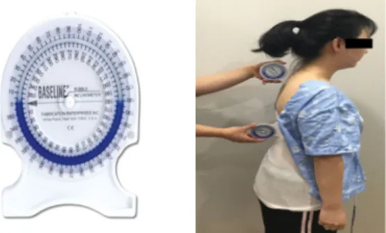 Fig 1. Thoracic kyphosis measurement