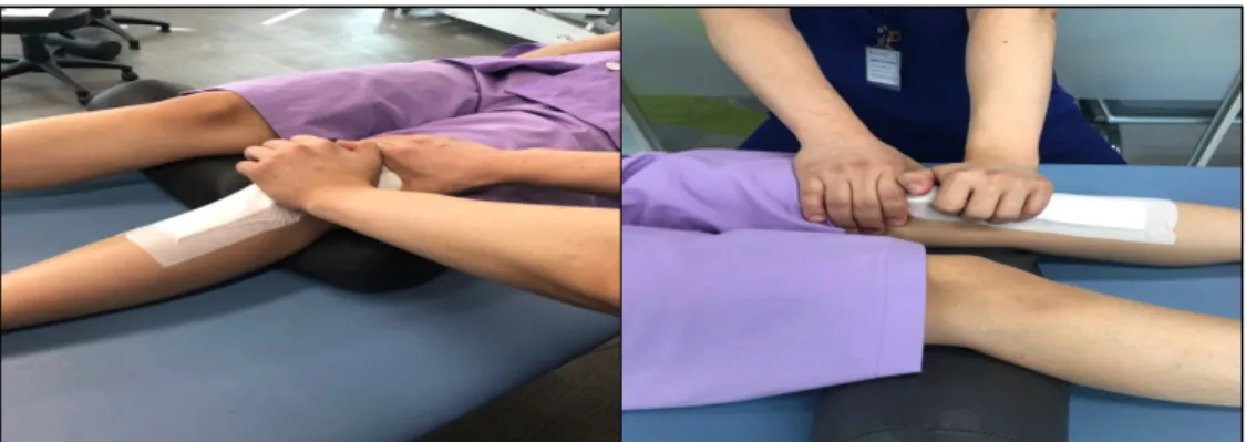Fig 6. Patella medial gilding 