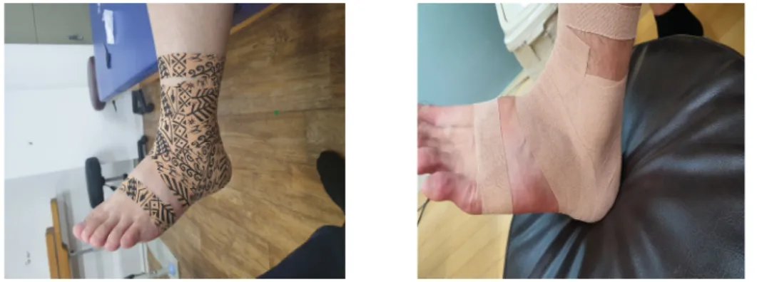 Fig 2. Taping application