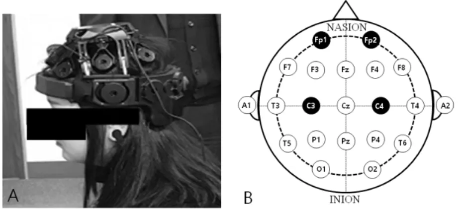 Fig 2. Electro-encephalography