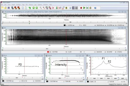 Fig 1. Acoustic analysis in vowel /a/