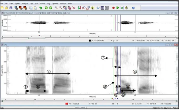 Fig 2. The analytic parameters of consonant in word /pata/ and /cokɛ/ 5.  통계 처리 1) 측정의 신뢰도 말명료도 분석에 대한 신뢰도를 측정하기 위해서 제 1 평가자인 본 연구자와 제 2평가자인 임상 경력 5년인 2 급 언어치료사가 전체 발화 샘플 중 10명의 자료에 대한  말명료도  평가  결과를  비교하였다