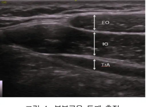표 2. 골반 앞기울임 차이에 따른 플랭크 운동 시 배가로근의 두께 비교 분석