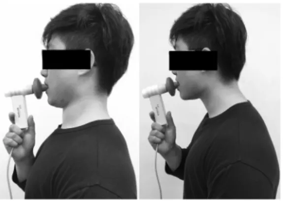표 1.  연구 대상자의 일반적  특성 (N=40) 2.  집단 내 자세 변화에 따른 기술통계 비교 1) 실험군의 자세 변화에 따른 폐 기능 비교 실험군에서  노력성  폐활량(FVC)은  전방머리자세  3.03±  0.36  ℓ,  인위적 중립자세 3.27±0.32  ℓ로 인위적 중립자세에 서 증가하였으며 (p<.05), 1초간 노력성 날숨량(FEV 1 )은 전 방머리자세 2.36±0.29  ℓ,  인위적 중립자세 2.75±0.27  ℓ로 인위적  