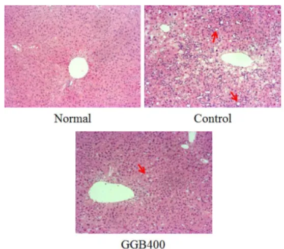 Fig. 13. Representative microscope photographs of  liver stained with hematoxylin and eosin.