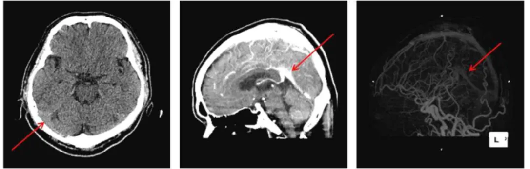 Fig. 2. Brain CT (2020.07.27).